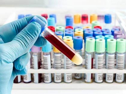 CoronaVirus Marathi News uae claims 73 covid 19 patients recovered from new treatment technique     | CoronaVirus News : यूएईचा दवा; कोरोनावरील नव्या उपचार पद्धतीने 73 जण झाले ठणठणीत