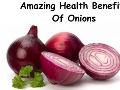 You know that the amazing benefits of onion! | ​आपणास माहिती आहेत का कांद्याचे आश्चर्यचकित फायदे !