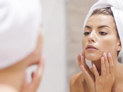 Take care of the skin! | आॅईली स्कीनची अशी घ्या काळजी! Take care of the skin! | आॅईली स्कीनची अशी घ्या काळजी!