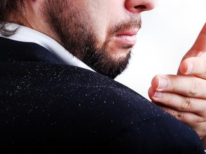 How was Dandruff? | डँड्रफ कसा तयार होता? How was Dandruff? | डँड्रफ कसा तयार होता?