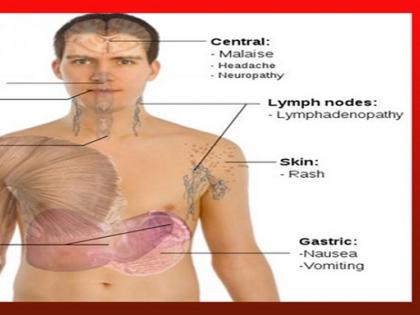 RESEARCH: ... the body is hidden in the 'AIDS' virus! | RESEARCH : ​...तर शरीरात ‘या’ ठिकाणी लपलेला असतो ‘एड्स’ व्हायरस !