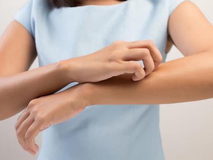 HEALTH: Do not neglect the body's 'itching', may be serious illness! | HEALTH : शरीरावरील ‘खाज’कडे करु नका दुर्लक्ष, असू शकतात गंभीर आजार !