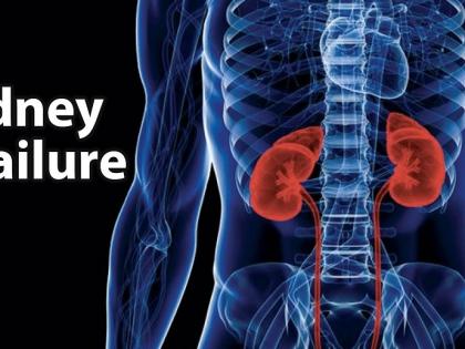 Health Alert: 'These' causes kidney failure! | Health Alert : ​‘या’ कारणांनी होते किडनी फेल !