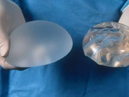 HEALTH: Breast Implant: Cancer's Backyard! | HEALTH : ब्रेस्ट इम्प्लांट : कॅन्सरचे माहेरघर!