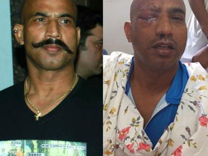 Shocking: Jitu Verma's eye saved briefly in the attack of robbers !! | Shocking : दरोडेखोरांच्या हल्ल्यात जितू वर्माचा डोळा थोडक्यात बचावला!!