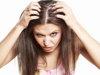 The hair is brittle! | केसांमध्ये कोंडा झालाय! The hair is brittle! | केसांमध्ये कोंडा झालाय!