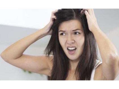 Home remedies for wearing bran | कोंडा घालविण्यासाठी घरगुती उपचार Home remedies for wearing bran | कोंडा घालविण्यासाठी घरगुती उपचार