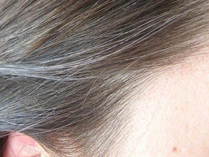 HEALTH: Get rid of ripe hair! | ​HEALTH : पिकलेल्या केसांपासून मिळवा मुक्ती !
