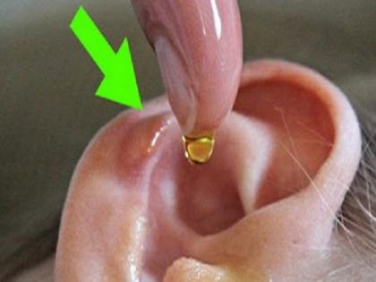 Health Tips: Clean the ear with these easy remedies! | Health Tips : ​कानाची सफाई करा ‘या’ सोप्या उपायांनी !