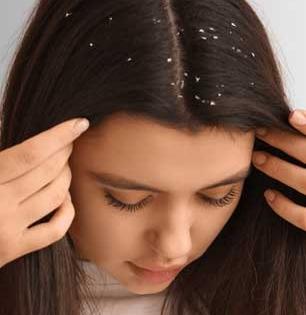 हिवाळ्यात कोंडा इतका वाढला, खांद्यावर पडतो? खोबरेल तेलात मिसळा १ पदार्थ - कोंडा कायमचा जाईल...