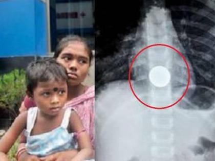 The girl took her shoulder to the hospitals, instead of being treated because of the treatment | मुलीला खांद्यावर घेऊन बापाची रुग्णालयांमध्ये धाव, उपचाराऐवजी मिळाली कारणं