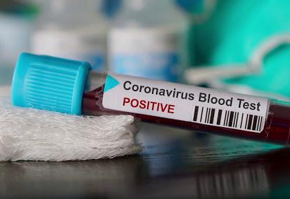 coronavirus: 86 positive till evening in Aurangabad; 835 patients | coronavirus : औरंगाबादमध्ये संध्याकाळपर्यंत ८६ पॉझिटिव्ह; रुग्णसंख्या ८३५