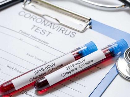 CoronaVirus Latur becomes covid 19 free after reports of 8 persons comes negative kkg | CoronaVirus: आता 'हा' जिल्हा झाला कोरोनामुक्त; आठही जणांचे अहवाल निगेटिव्ह आल्यानं मोठा दिलासा