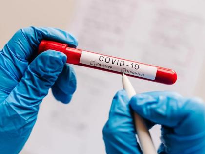 87-year-old Corona patient from Pune is in good health; discharged home after treatment | Corona Virus: कोरोनाच्या पुण्यातील ८७ वर्षीय रुग्णाची तब्येत ठणठणीत; उपचारानंतर घरी सोडले 87-year-old Corona patient from Pune is in good health; discharged home after treatment | Corona Virus: कोरोनाच्या पुण्यातील ८७ वर्षीय रुग्णाची तब्येत ठणठणीत; उपचारानंतर घरी सोडले
