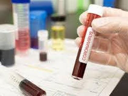 On the second day of discharge young man was again tested positive for coronavirus | CoronaVirus News: अरे बापरे! डिस्चार्ज मिळाल्याच्या दुसऱ्या दिवशी तरुण पुन्हा पॉझिटिव्ह