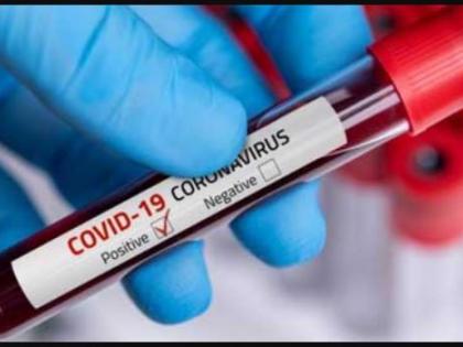 Corona virus in Nagpur: 10 patients tested positive in Nagpur, one died | CoronaVirus in Nagpur : नागपुरात ३१ रुग्ण पॉझिटिव्ह, एकाचा मृत्यू