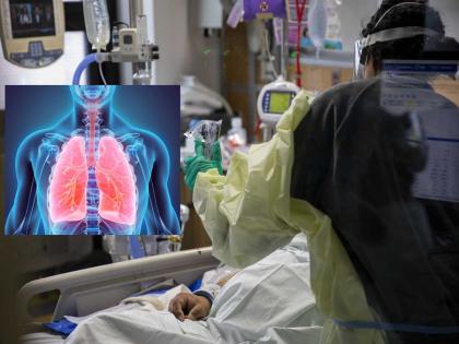 Corona Virus: Severe damage to lungs due to Corona, an alarming symptom found in 11 percent of patients | Corona Virus: कोरोनामुळे फुप्फुसांचं प्रचंड नुकसान, ११ टक्के रुग्णांमध्ये सापडलं चिंताजनक लक्षण   