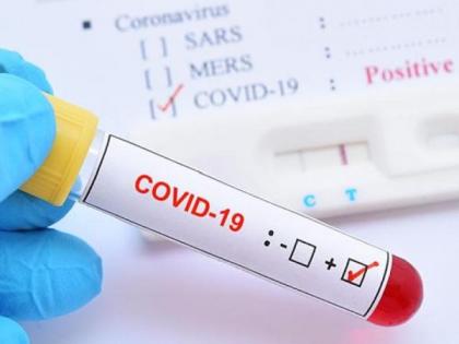 24 new patients registered in Vidarbha; The number of corona patients crossed the 400 mark | विदर्भात २४ नव्या रुग्णांची नोंद; कोरोना रुग्ण संख्येने ४०० चा टप्पा ओलांडला