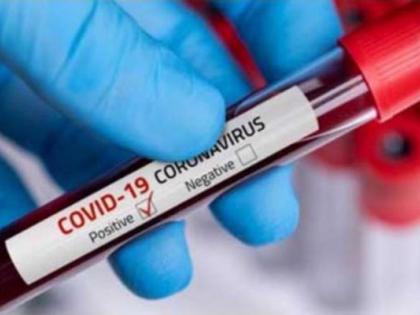 Corona Virus in Nagpur: 71 patients tested positive in Nagpur, one died: Rise in rural areas | CoronaVirus in Nagpur : नागपुरात ७१ रुग्ण पॉझिटिव्ह, एकाचा मृत्यू : ग्रामीण भागातही वाढ