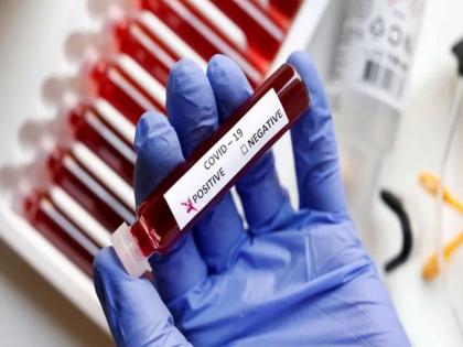 53 Corona patients in Mumbai, BMC Municipal Corporation on alert; Hospitals ready for emergency situation | मुंबईत कोरोनाचे ५३ रुग्ण, महापालिका सतर्क; आपत्कालीन परिस्थितीसाठी रुग्णालये सज्ज 53 Corona patients in Mumbai, BMC Municipal Corporation on alert; Hospitals ready for emergency situation | मुंबईत कोरोनाचे ५३ रुग्ण, महापालिका सतर्क; आपत्कालीन परिस्थितीसाठी रुग्णालये सज्ज