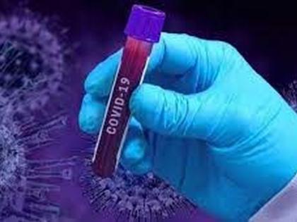 CoronaVirus: 24 new positive patients were found in Akola | CoronaVirus : रुग्णवाढीचे सत्र सुरुच; २४ नवे पॉझिटिव्ह रुग्ण आढळले