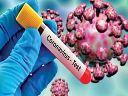 Coronavirus in Akola: 1 death in a day; 33 positive; Total patients at 341 | CoronaVirus in Akola : दिवसभरात १ मृत्यू; ३३ पॉझिटिव्ह; एकूण रुग्ण ३४१ वर