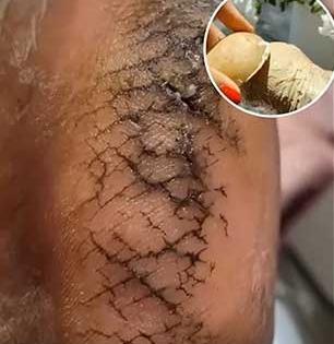 भेगाळलेल्या टाचांवर स्वयंपाक घरातील ३ पदार्थ असरदार! रोज करा मालिश - टाचा होतील मऊ - मुलायम...