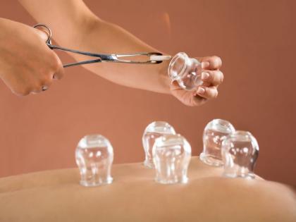 health benefits of cupping therapy | हॉलिवूडसह अनेक बॉलिवूड अभिनेत्रींमध्येही 'या' वेदनादायी थेरपीचा ट्रेन्ड!