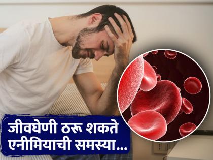 Anaemia symptoms, causes and the ways to prevent it | काय आहे एनीमिया आणि काय असतात याची लक्षण? वेळीच व्हा सावध!