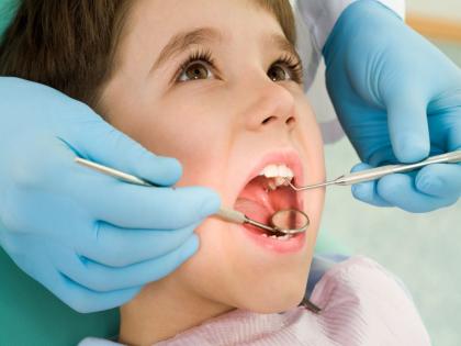 40 percent of children have decayed teeth; Three thousand children were examined by the Government Dental Hospital | ४० टक्के मुलांचे दात किडलेले; शासकीय दंत रुग्णालयाने केली तीन हजार बालकांची तपासणी