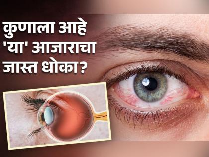 Expert says by 2040 age related macular degeneration may affect 300 million people worldwide | 2040 पर्यंत 30 कोटींपेक्षा अधिक लोकांना होऊ शकतो डोळ्यांचा हा गंभीर आजार, जाणून घ्या धोका!