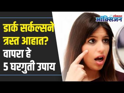 डार्क सर्कल्स घालवण्यासाठी घरगुती उपाय | 5 Ways to Deal With Dark Circles | Remove Dark Circles