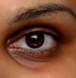 महागड्या आय-क्रीम विसरा! आजीच्या ३ देसी उपायांनी डार्क सर्कल्स होतील कमी - आठवड्याभरात चेहराही टवटवीत