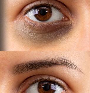 डोळ्यांखाली काळी वर्तुळं? २ सोपे उपाय, निस्तेज डोळे होतील सुंदर- त्वचेचा ग्लो वाढतच जाईल...!