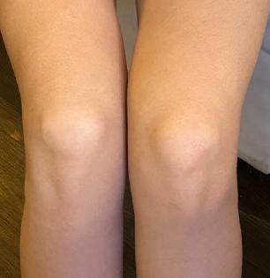 २ रुपयांच्या कॉफीने हातांचे कोपरे- गुडघ्यांचा काळपटपणा होतो दूर, पाहा १० मिनिटांचा सोपा उपाय