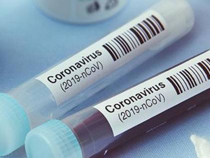 CoronaVirus in Akola: Death of another; 38 positive, 1703 patients | CoronaVirus in Akola : आणखी एकाचा मृत्यू; ३८ पॉझिटिव्ह, रुग्णसंख्या १७०३