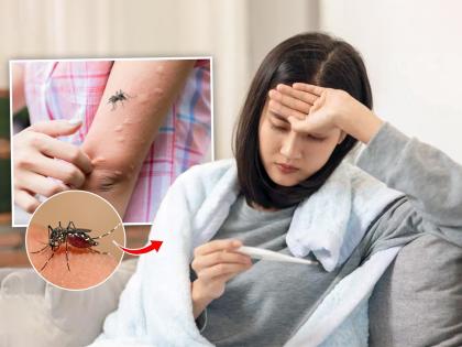 dengue virus can directly infect brain causing inflammation and swelling which lead to encephalitis | डेंग्यूचा फक्त शरीरावरच नाही तर मेंदूवरही होतो वाईट परिणाम?; आरोग्य तज्ज्ञ म्हणतात...