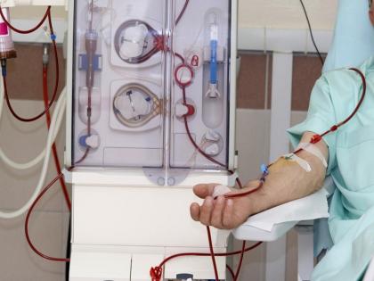 Corona examination condition for dialysis is more trouble maker; Possibility of death | डायलिसिससाठी कोरोना तपासणीची अट तापदायक; उशीर जीवावर बेतण्याची शक्यता