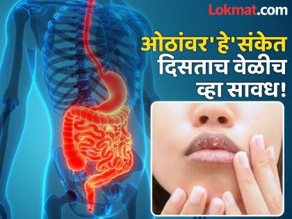 Dangerous diseases symptoms you can see on lips | आयुर्वेद डॉक्टरांनुसार ओठांवर दिसतात 'या' गंभीर आजारांचे संकेत, दुर्लक्ष करणं पडेल महागात...