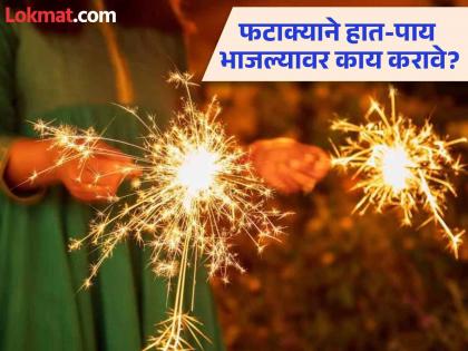 Doctor tells how to treat burns on Diwali home remedies | डॉक्टरांनी सांगितलं दिवाळीला फटाक्याने त्वचा भाजल्यावर काय करावं आणि काय करू नये!