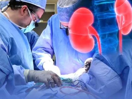 The doctor removed the kidney from the patient's body instead of the kidney, followed by shocking information | डॉक्टरांनी रुग्णाच्या शरीरातून मुतखड्याऐवजी काढली किडनी, त्यानंतर समोर आली धक्कादायक माहिती