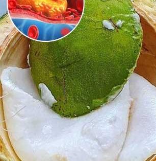 शहाळ्याची मलई खाल्ल्याने खरंच कोलेस्टेरॉल वाढतं का ? डाएटिशियन सांगतात, दिवसाला किती आणि कशी खावी मलई...