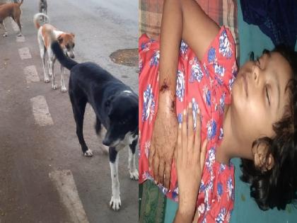 a stray dog broke the girl legs and injured her In Sangli | सांगलीत पिसाळलेल्या कुत्र्याने बालिकेचे लचके तोडले, बालिका जखमी