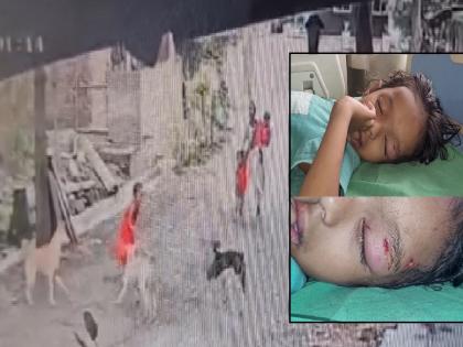 Stray dogs attack six year-old girl in Ichalkaranji kolhapur | Kolhapur: भटक्या कुत्र्यांचा चिमुकलीवर हल्ला, सुमारे २० फूट फरफटत नेले; इचलकरंजीतील घटना Stray dogs attack six year-old girl in Ichalkaranji kolhapur | Kolhapur: भटक्या कुत्र्यांचा चिमुकलीवर हल्ला, सुमारे २० फूट फरफटत नेले; इचलकरंजीतील घटना
