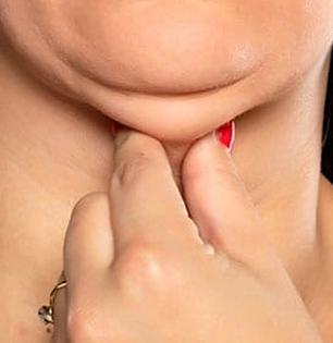 डबल चीनमुळे चेहरा दिसतो सुजलेला - जाडजूड? पाहा हनुवटीभोवती साचलेली चरबी कमी करण्यासाठी उपाय