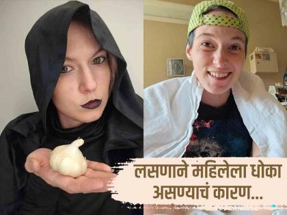 Woman weird disease garlic can kill if eaten in large | लसूण खाल्ला तर जाऊ शकतो 'या' महिलेचा जीव, कारण वाचून व्हाल अवाक्! 