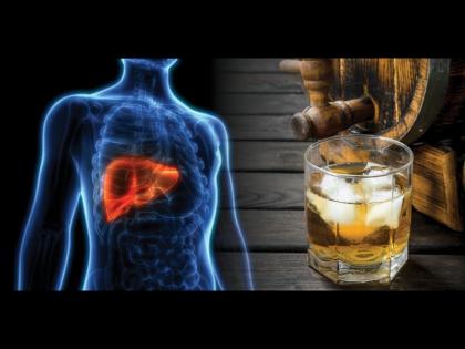 These 6 alcohol related liver disease symptoms and safe quantity for drinking | दारूने सडत असेल लिव्हर तर दिसतात ही 6 लक्षण, वेळीच सावध व्हाल तर वाचाल!