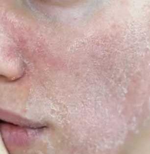 थंडीचे ३ दोस्त-हिवाळ्यातले ३ सुपरफूड-केस आणि त्वचेसह बदलून टाकतील तुमचं रुप, दिसाल सुंदर-फिट