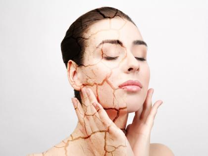 How to care skin and body in coming winter season | आता हिवाळ्यात कोरडी होणार नाही त्वचा; वापरा 'या' टिप्स How to care skin and body in coming winter season | आता हिवाळ्यात कोरडी होणार नाही त्वचा; वापरा 'या' टिप्स
