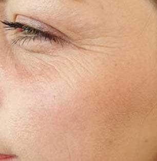 थंडीत चेहरा काळवंडलाय, सुरकुत्या- कोरडा पडला? 'या' ७ सवयी आजच बदला, त्वचा होईल सॉफ्ट-रंगही उजळेल